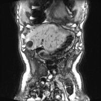 HL017_191212 project thumbnail