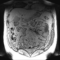 HL043_200121 project thumbnail