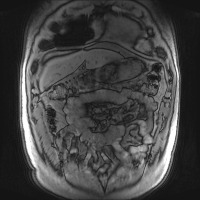 HL040_191206 project thumbnail