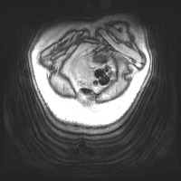 HL038_190803 project thumbnail