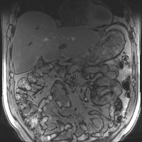 HL039_190906 project thumbnail