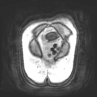 HL038_190906 project thumbnail