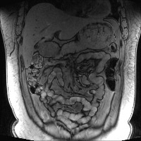 HL010_190829 project thumbnail