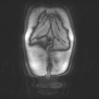 HL019_200110 project thumbnail