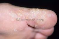 Skin disease project thumbnail