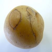 Potato Diseases project thumbnail
