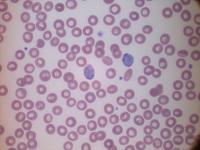 Malaria_Dataset project thumbnail
