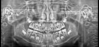 dataToprocess project thumbnail