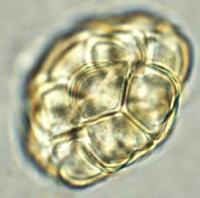 pollenidentification project thumbnail