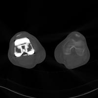 Knee CT Detection  project thumbnail