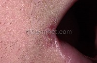 Derma Advisor project thumbnail