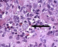 GENERAL PATHOLOGY  project thumbnail