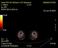 akbas_ayten project thumbnail