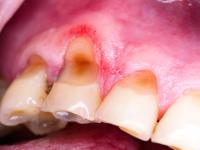 Cavity detection project thumbnail
