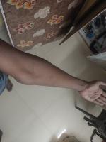 elbow project thumbnail