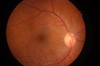 FSL-Lesion-Detection project thumbnail