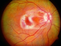 Enhanced Retinal Images project thumbnail