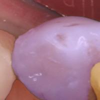 Test-Cavity project thumbnail