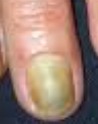 yellow nails project thumbnail
