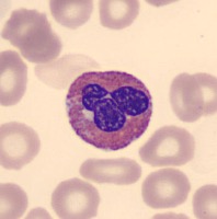 Blood_Cell_Classification Object Detection Model by blood cell