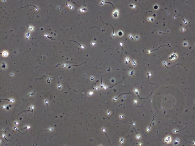 Sperm Cell Detection V2 Object Detection Dataset and Pre-Trained Model ...