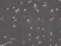 AI Sperm project thumbnail