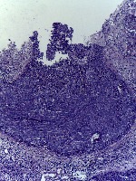 img_augm project thumbnail