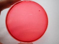Bacteria Colony Counter project thumbnail