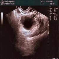 Follicle Instance Segmentation project thumbnail