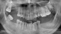 Radiodiagnosis project thumbnail