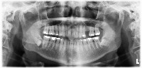 winter classes project thumbnail