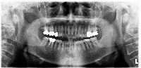 teeth  project thumbnail