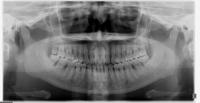 dental project thumbnail