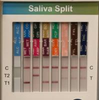 salivaSplit project thumbnail