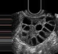 follicle detection project thumbnail