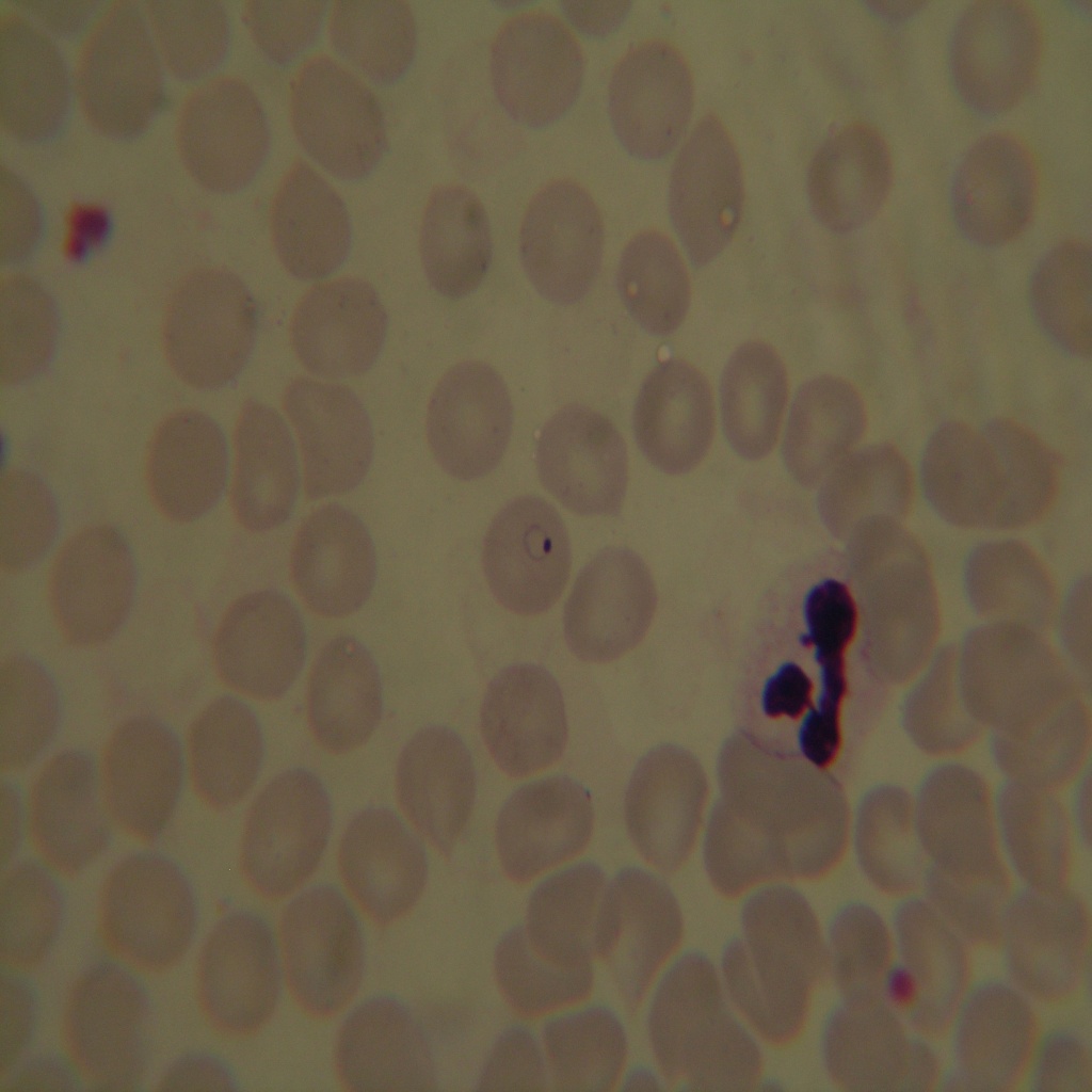 rbc2 Instance Segmentation Dataset by cells