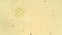 Detect microalgae project thumbnail