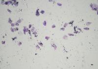 Find cells project thumbnail