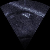 Sonar Images project thumbnail