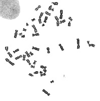 chromosome-yolov5 project thumbnail