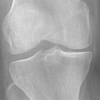 20240914_座標點轉Box資料集 Object Detection Dataset by Knee joint space ...