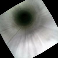 Medical endoscopic image detecti Instance Segmentation Dataset by Jiachen