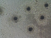 Egg segmentation project thumbnail