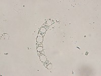 PhytoPlankton PMID2019 project thumbnail