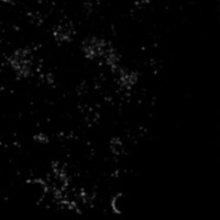 Septin-Seg project thumbnail