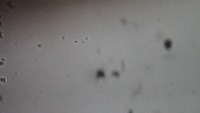 chagas project thumbnail