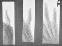 Fraction Detection project thumbnail