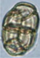 Pollen Grains project thumbnail
