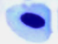 Erythrocyte_Abnormalities 4 project thumbnail