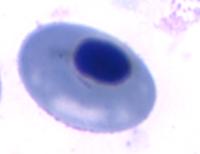 Erythrocyte_Abnormalities_3 project thumbnail